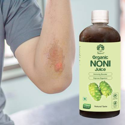 Jaisvi Noni Juice Concentrate Wound Healing, Noni Health Drink, Immune Booster 750 ML