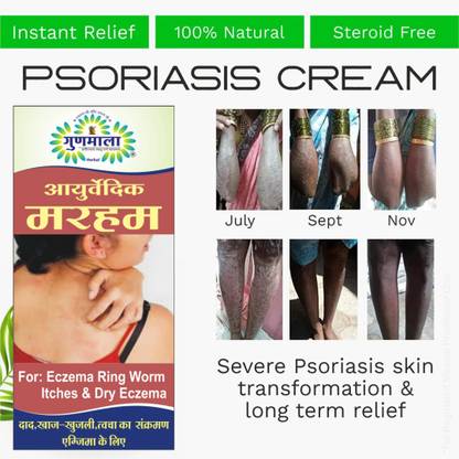 Gunmala Ringworm Ointment / Ayurvedic Marham, For Effective Treatment Eczema & Red Rash