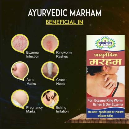 Gunmala eczema or leucoderma ointment, for ringworm & effective vitiligo treatment