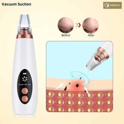 FURESTA Plastic Blackhead Remover Vacuum Suction Device
