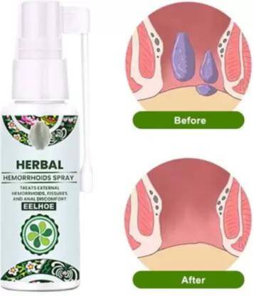 CHIWA Natural Herbal Hemorrhoids Spray Spray (100 g) Spray