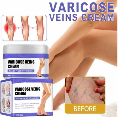 Prefetto COSMO 101 % ORIGINAL Varicose Veins Cream Cream