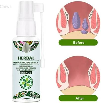 CHIWA HEMOCARE HERBAL HEMORRHOIDS SPRAY 50ML Liquid