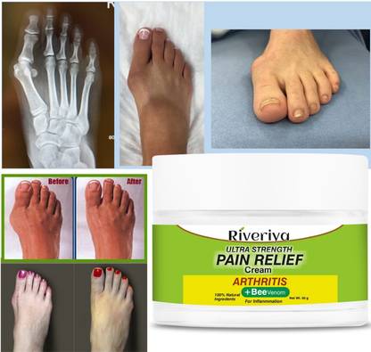 RIVERIYA Bee Venom Joint and Bone Cream - Bee Venom Cream Cream