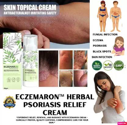 WEEDY Eczemaron Anti Fungal & Healing Cream Pack of 1 Gel