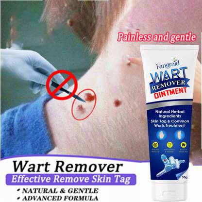 UPASTHIT Wart remover ointment cream for Best wart removal