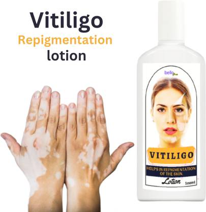 BelloMe Vitiligo-Leucoderma Lotion for Skin Pigmentation & White Patches
