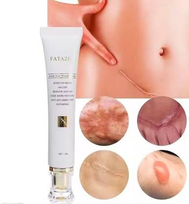 LILY GLOW Scar removal cream stretch mark keloid remove scars acne mark removal