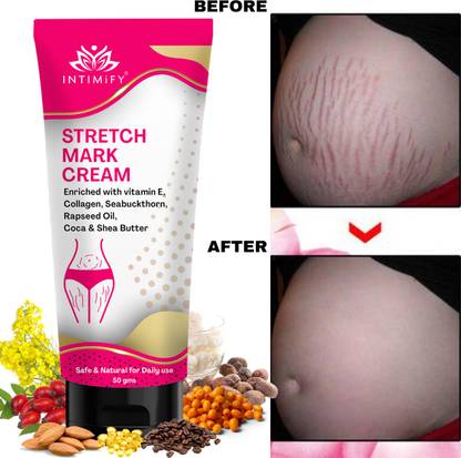 INTIMIFY Stretch Mark Cream For Women, Remove Pregnancy stretch marks Intimate Cream