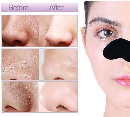 tanvi27 Charcoal Nose Strips