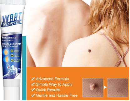 ADJD Best Warts Remover Wart Cream Skin Tag Remover Herbal Extract