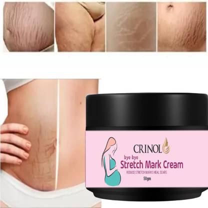 crinol Stretch Marks Scar removal cream 4 Hyperpigmentation,remover scars [50ml]