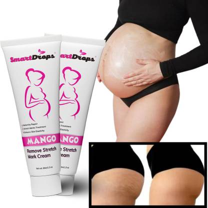 smartdrops Stretch Marks Tube to Reduce Stretch Marks of Body Uneven Skin Tone