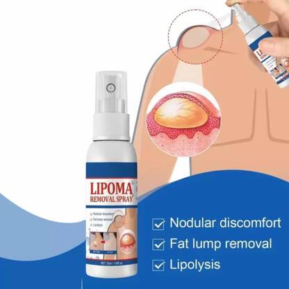 PHIZLLER Lipoma Removal Spray Complete Solution for Lipoma and Lump Fat Removal (60 ml)