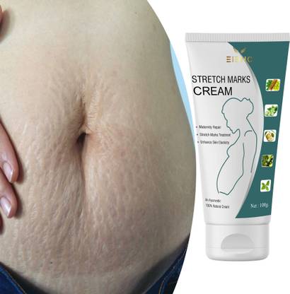 EIBHC Scar Removal Cream Stretch Mark, Surgery, Injury, Suitable for All Skin Types