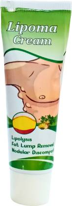 SIYDHA Lipoma On Shoulder Fatty Lump On Head lipoma remover cream