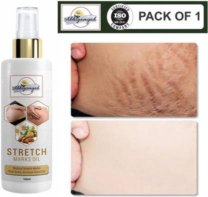ABHIGAMYAH Stretch Marks Oil to Reduce Stretch Marks of Body Uneven Skin Tone, Firming100ml