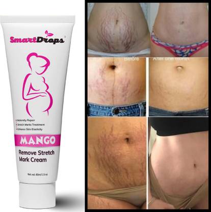 smartdrops ScarEase Solution For Men & Women