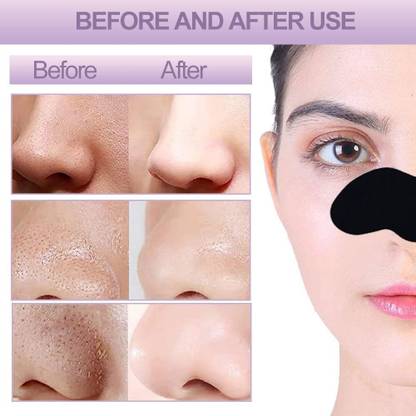 DYSOKAYO Charcoal Nose Strips for Blackheads