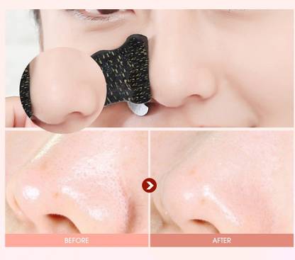 DARVING Charcoal Nose Strips (Men) - Blackhead Remover