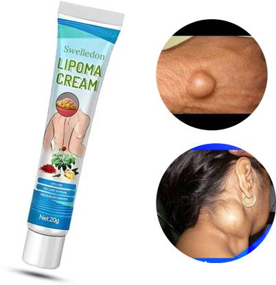 SWELLEDON Lipoma Removal Herbal Cream 20g