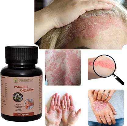 Sifa Ayurveda Is A Natural , , Acne, 60