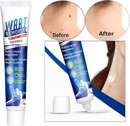 marchid Warts Treatment Unique Cream Removal (20 g)