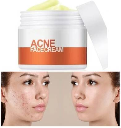 AFARAXIA Best acne cream for acne Spot Treatment for Face & Acne Dots