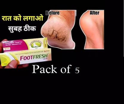 ULTRABIZ new-F O O T FRES 25GM(PACK OF 5)LELO