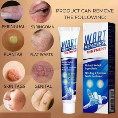 marchid Wart Remover Cream, Massa Removal Cream Pack of 1 of 100G (100 g)