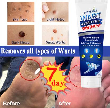 REGLET Wart remover ointment All Anti-WART Remover Cream
