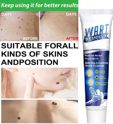 THTC Cream For Wart Remover