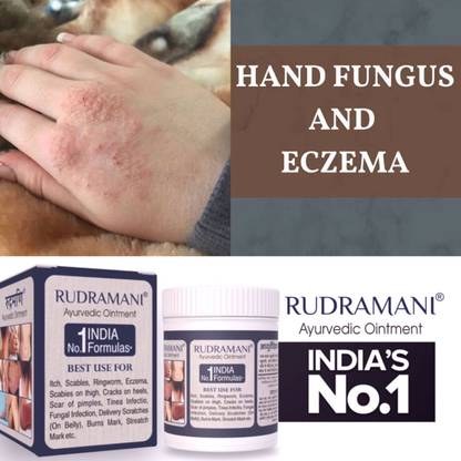 Rudramani Eczema ointment skin Fungal Infection cream-50gm Pack of -2 Pis