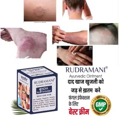 Rudramani Anti-Fungal Skin Infection ,Eczema & Fungal Infection Marham for Skin Care