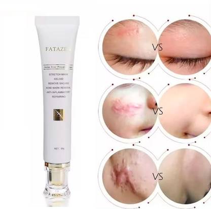 LILY GLOW Acne Scar Removal Cream Pimples Stretch Marks Remove Face Gel