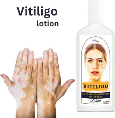 BelloMe Ayurveda Lotion For Vitiligo, White Patches On The Skin