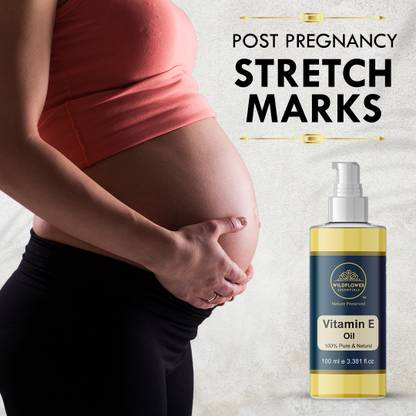 Wildflower essentials Vitamin E Oil For Post Pregnancy Stretch Marks Reduces