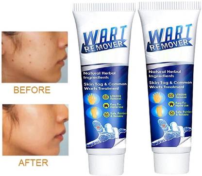 MYEONG Mole Remover Gel