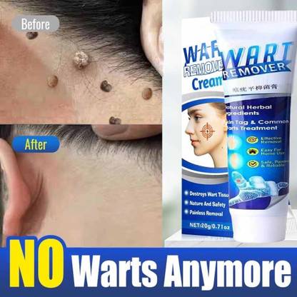 WOONGMI Warts Remover Original 100% Authentic Warts Removal Cream Skin Tags
