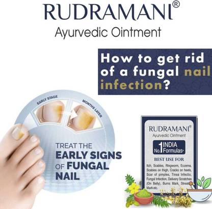 Rudramani Nail Infection Ointment