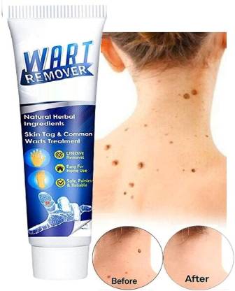 MYEONG Wart Removal Cream Helps to remove toughest Wart