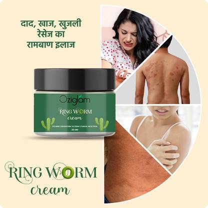 Oziglam Ayurvedic Cream for Ringworm, Itching, Eczema & Circular Lash For Men & Women