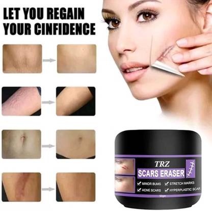 TRZ Scar Repair Removal Cream treatment of all scars without Leaving Scars