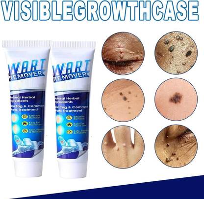 YAWI best Wart Remover Cream Removal Cream