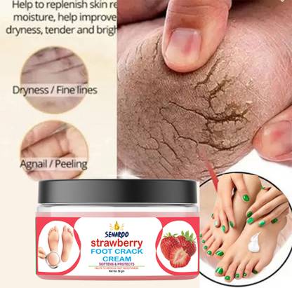 SENAROO cracked heels for foot cream