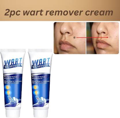 RAZY Wart Remover Cream, Massa Removal Cream, For Face & Skin