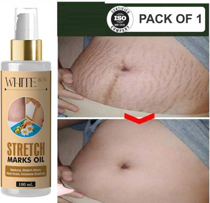 white bon Stretch Marks Cream to Reduce Stretch Marks & Scars