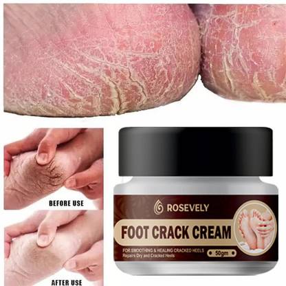Rosevely Smooth Soft & Clean Skin|Face & Body Cream |Skin Whitening Cream for Men &Women