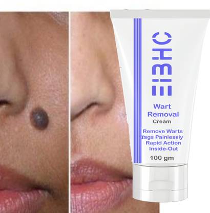 EIBHC Wart remover cream for wart Free Skin for all mole remover cream