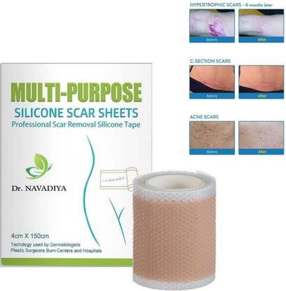 Dr. NAvadiya Silicone Scar Sheets(1.6X 120Roll-3M) Scar Removal Silicone Scar Tape